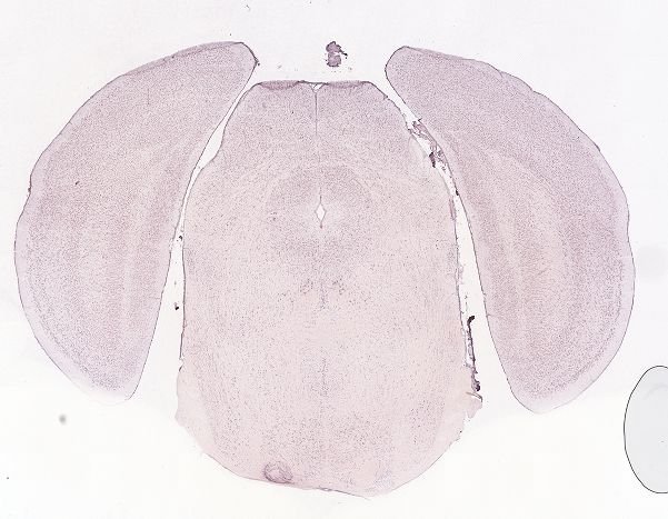 Allen ISH experiment 74511770, image 74396469 -- target region: OV (Vascular organ of the lamina terminalis)