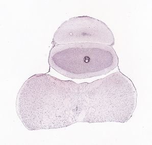 Allen ISH experiment 79591399, image 79603741 -- target region: SCO (Subcommissural organ)