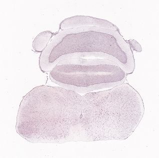 Allen ISH experiment 79591399, image 79603743 -- target region: SCO (Subcommissural organ)
