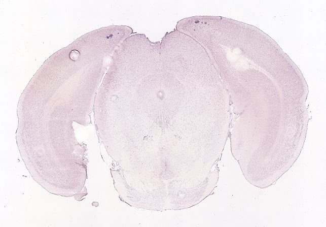Allen ISH experiment 71247615, image 71115307 -- target region: CP (Caudoputamen)