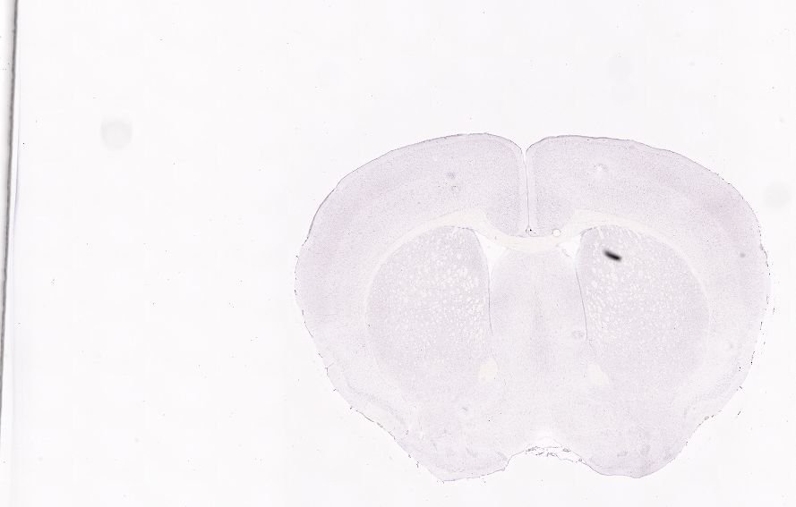 Allen ISH experiment 77869800, image 77876748 -- target region: III (Oculomotor nucleus)