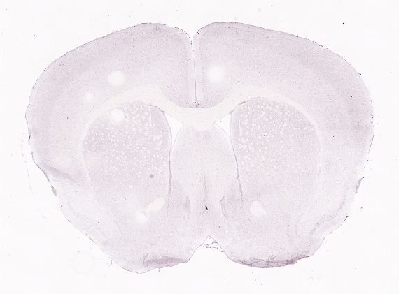 Allen ISH experiment 77869800, image 77876754 -- target region: III (Oculomotor nucleus)