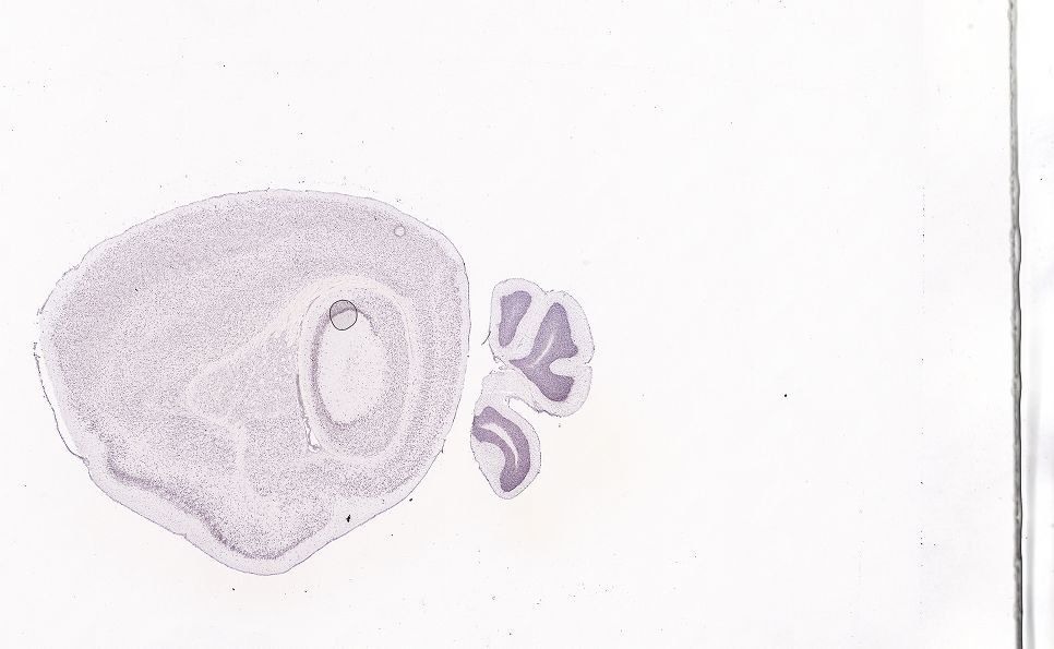 Allen ISH experiment 81600602, image 81596835 -- target region: SCH (Suprachiasmatic nucleus)