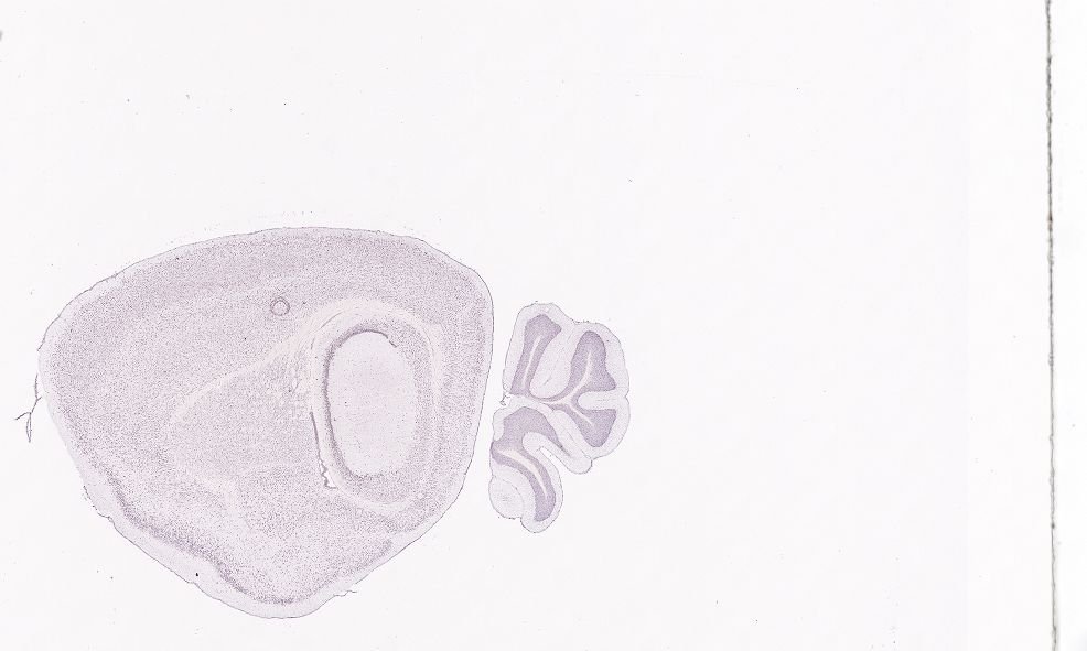 Allen ISH experiment 81600602, image 81596837 -- target region: SCH (Suprachiasmatic nucleus)