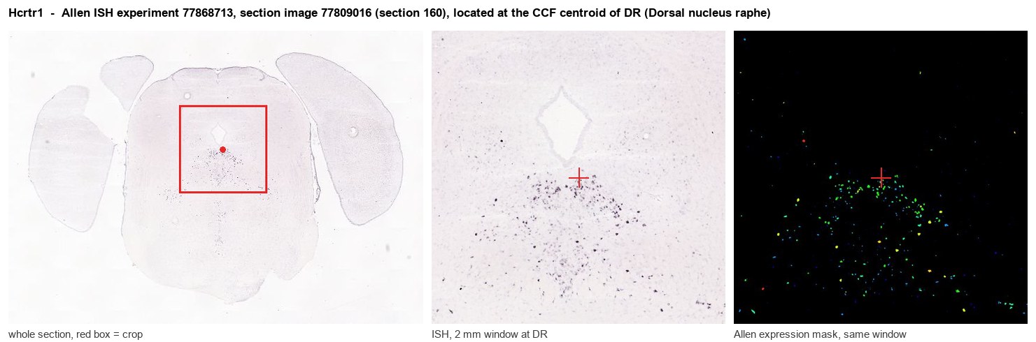 Hcrtr1 Allen ISH at the CCF centroid of DR