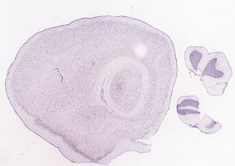 Allen ISH experiment 69257767, image 69148850 -- target region: OV (Vascular organ of the lamina terminalis)