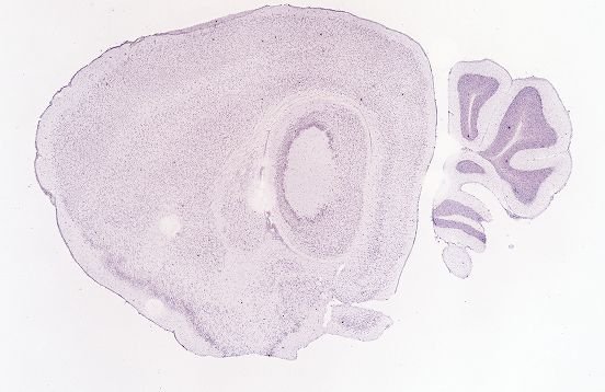 Allen ISH experiment 69257767, image 69148852 -- target region: OV (Vascular organ of the lamina terminalis)