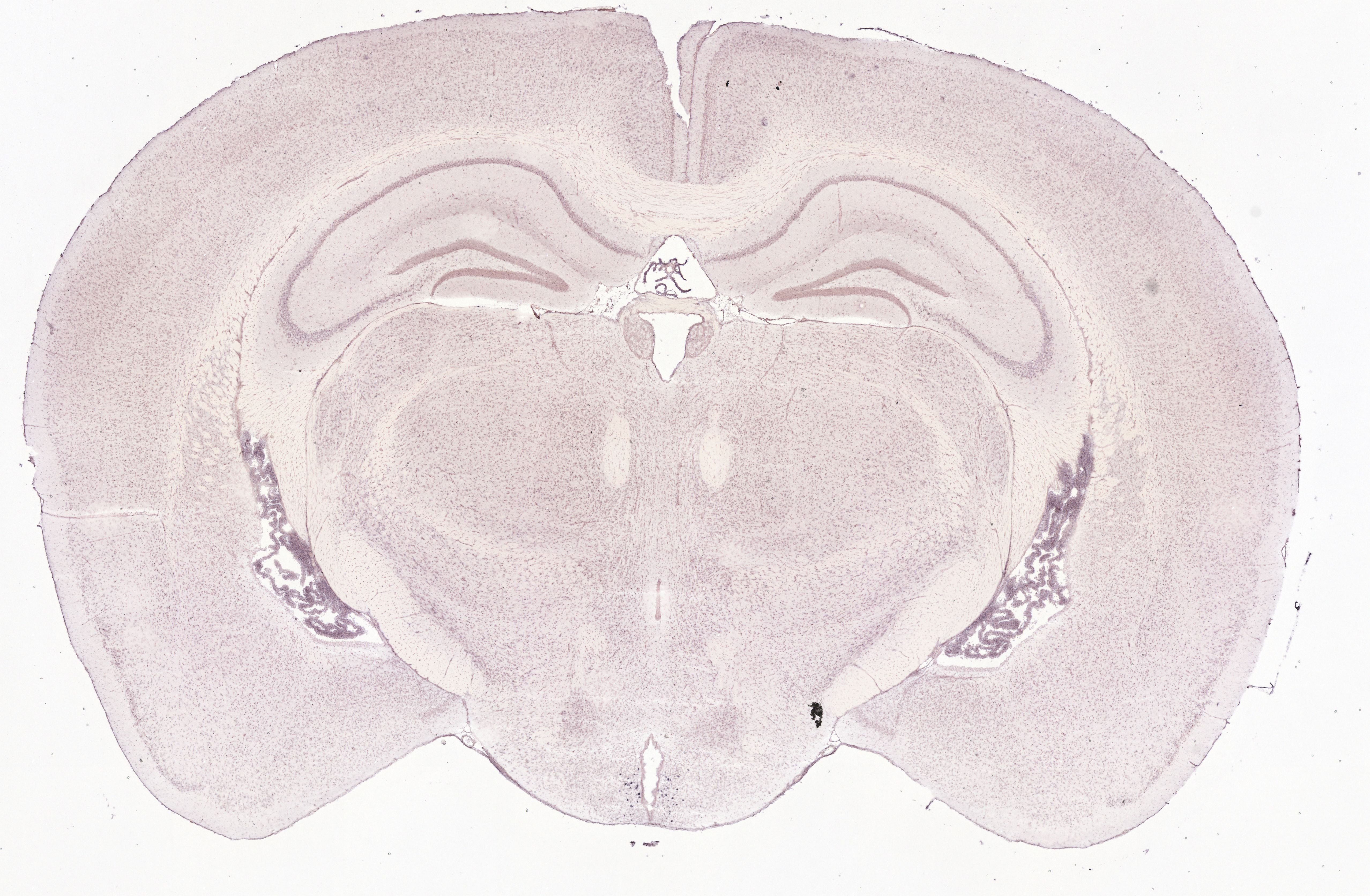 Allen ISH experiment 74641318, image 74531972 -- target region: ARH (Arcuate hypothalamic nucleus)