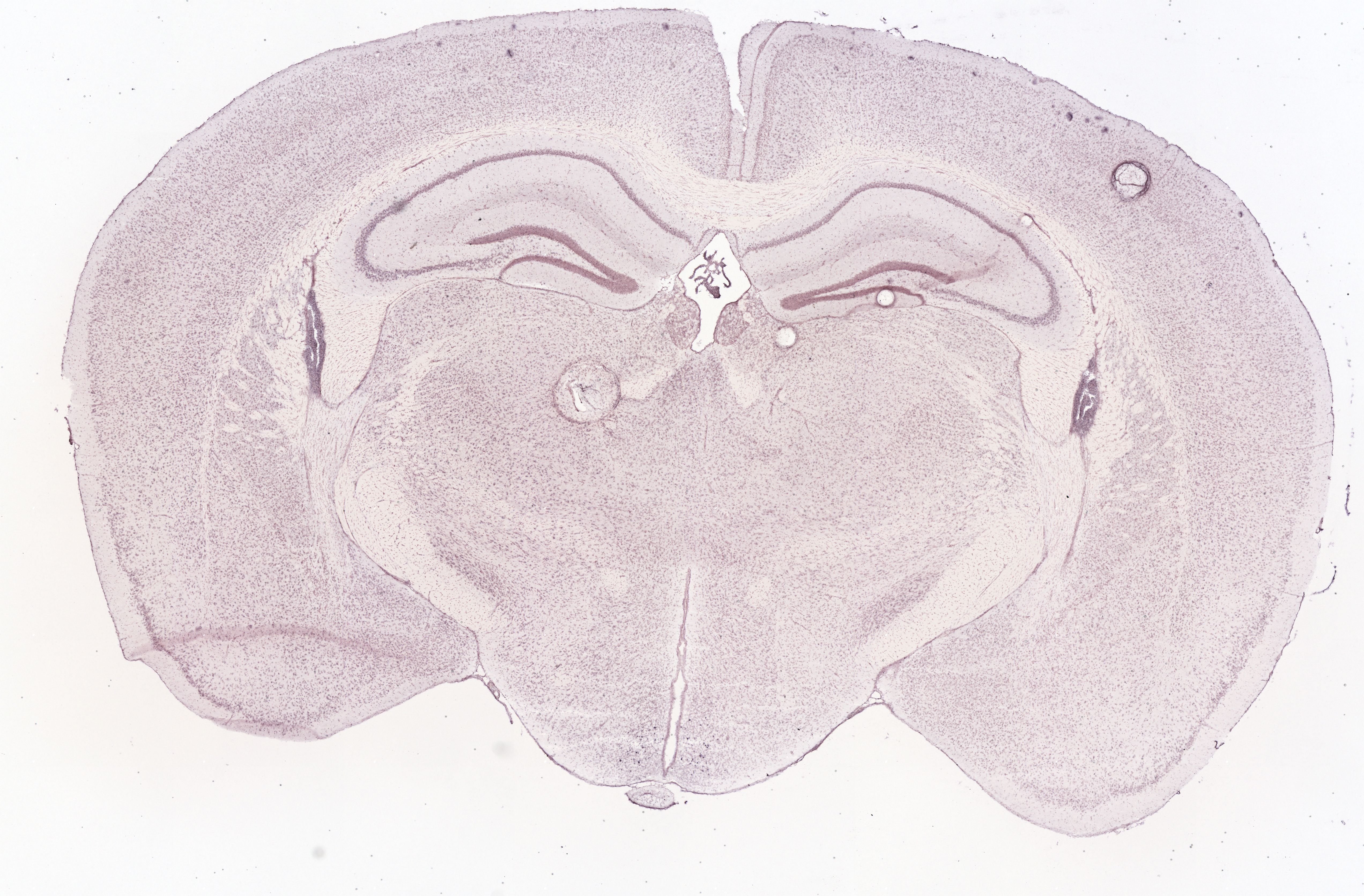 Allen ISH experiment 74641318, image 74531976 -- target region: ARH (Arcuate hypothalamic nucleus)