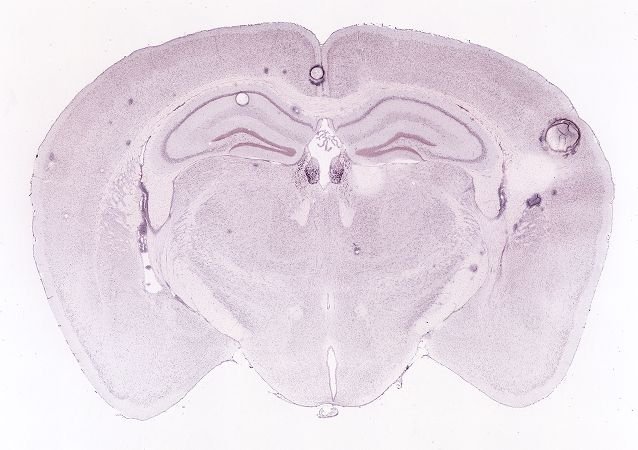 Allen ISH experiment 71247644, image 71092892 -- target region: MH (Medial habenula)