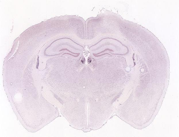 Allen ISH experiment 71247644, image 71092894 -- target region: MH (Medial habenula)