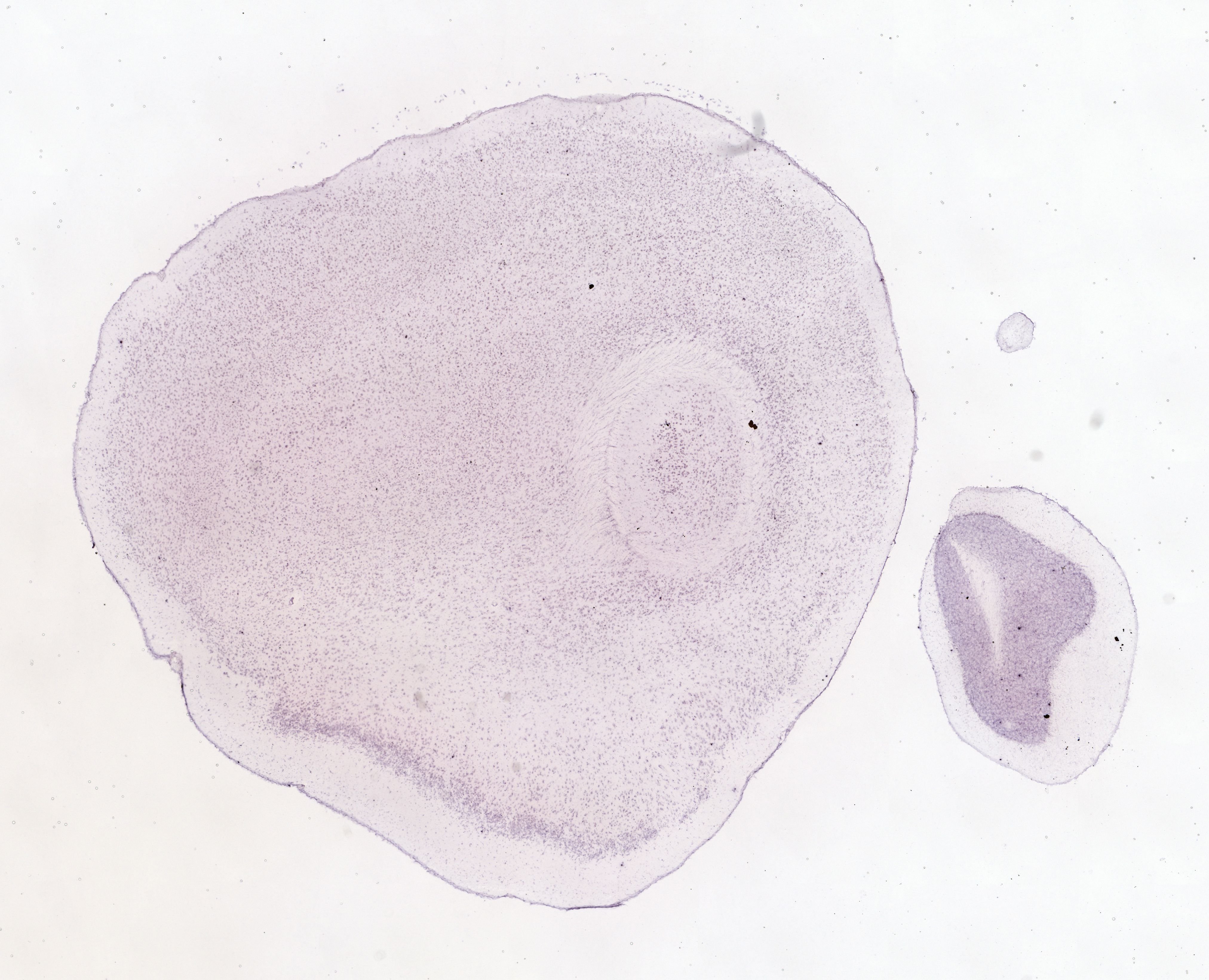 Allen ISH experiment 69257993, image 69150737 -- target region: VMH (Ventromedial hypothalamic nucleus)