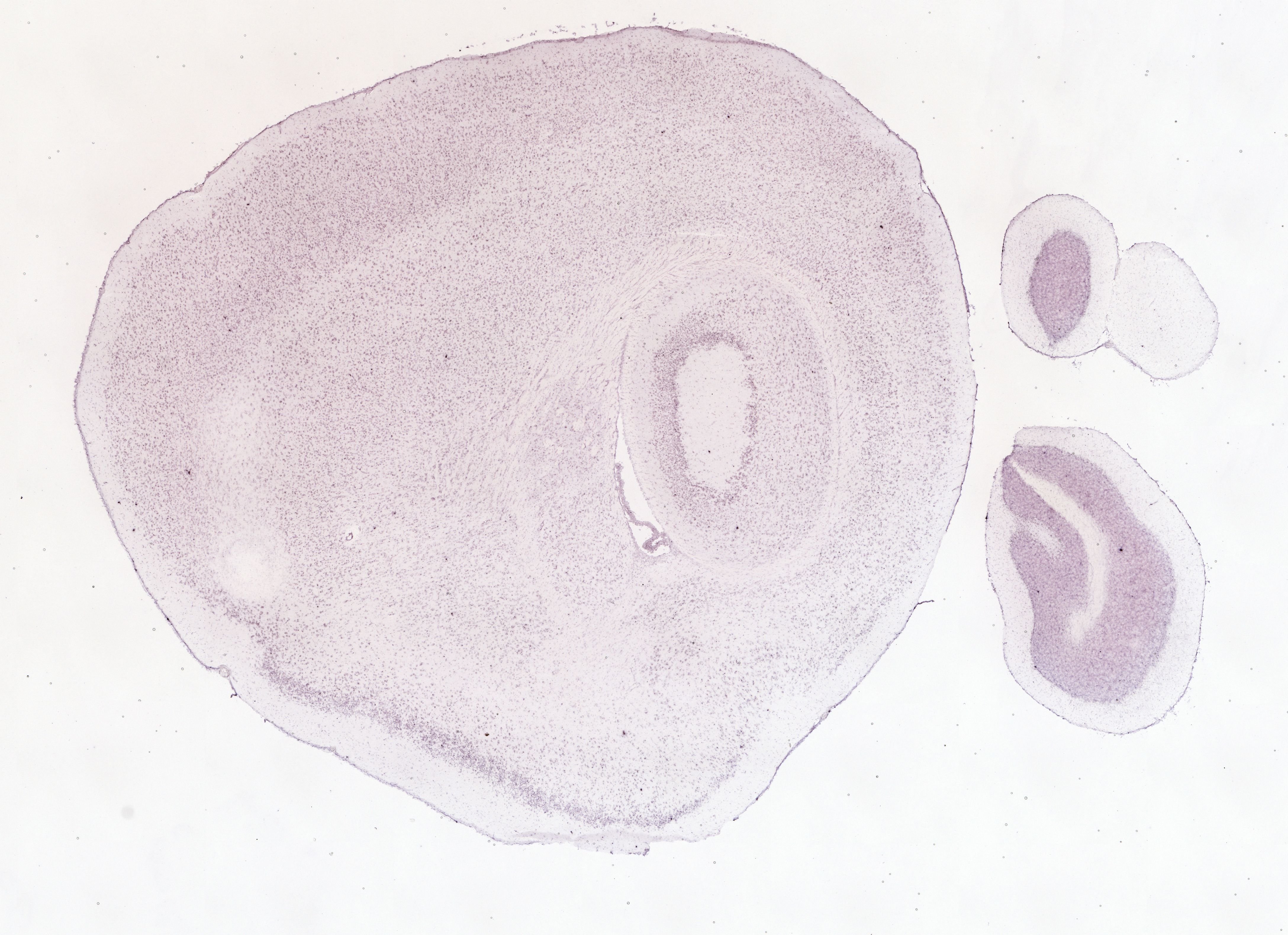 Allen ISH experiment 69257993, image 69150739 -- target region: VMH (Ventromedial hypothalamic nucleus)