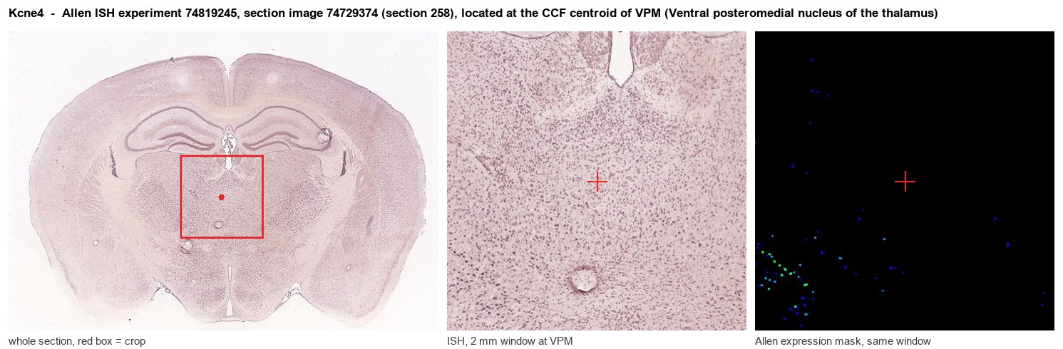 Kcne4 Allen ISH at the CCF centroid of VPM