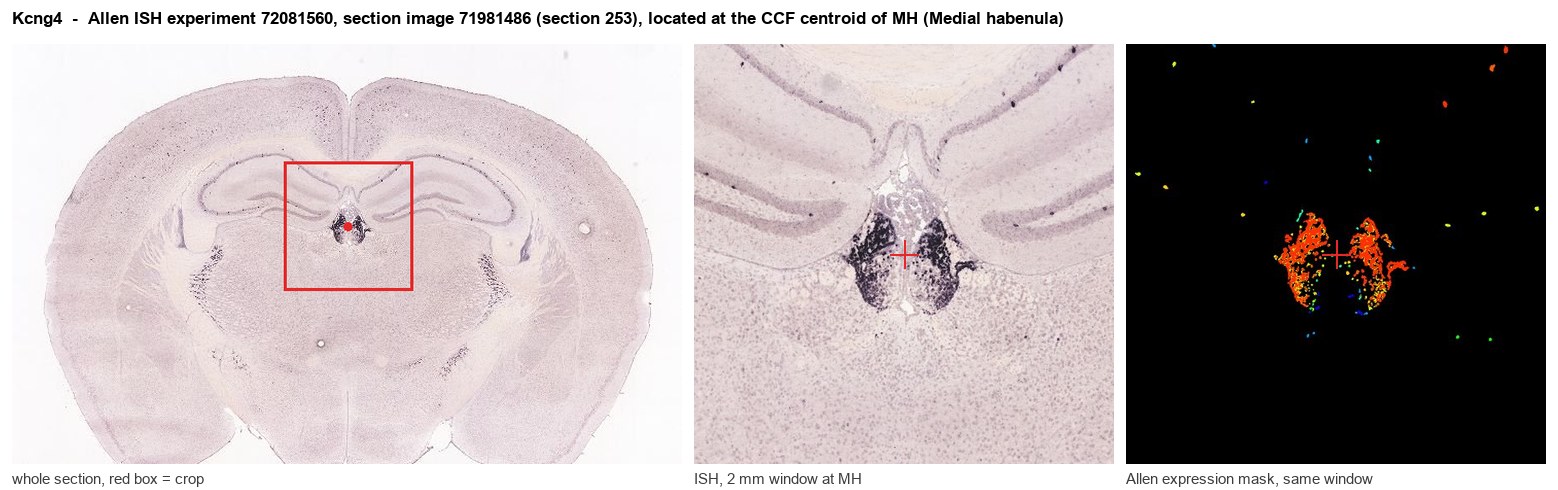 Kcng4 Allen ISH at the CCF centroid of MH