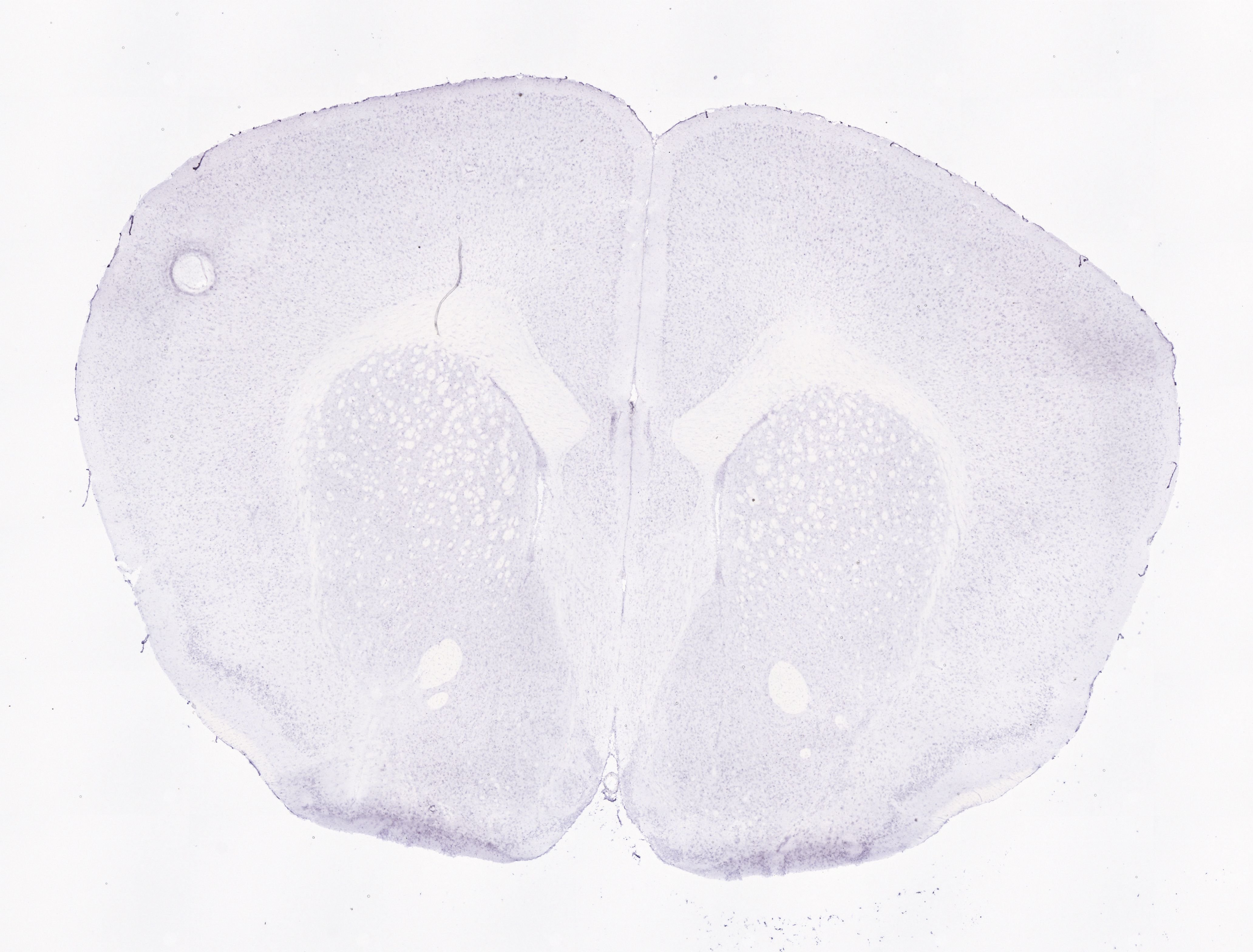 Allen ISH experiment 75651203, image 75588928 -- target region: V (Motor nucleus of trigeminal)