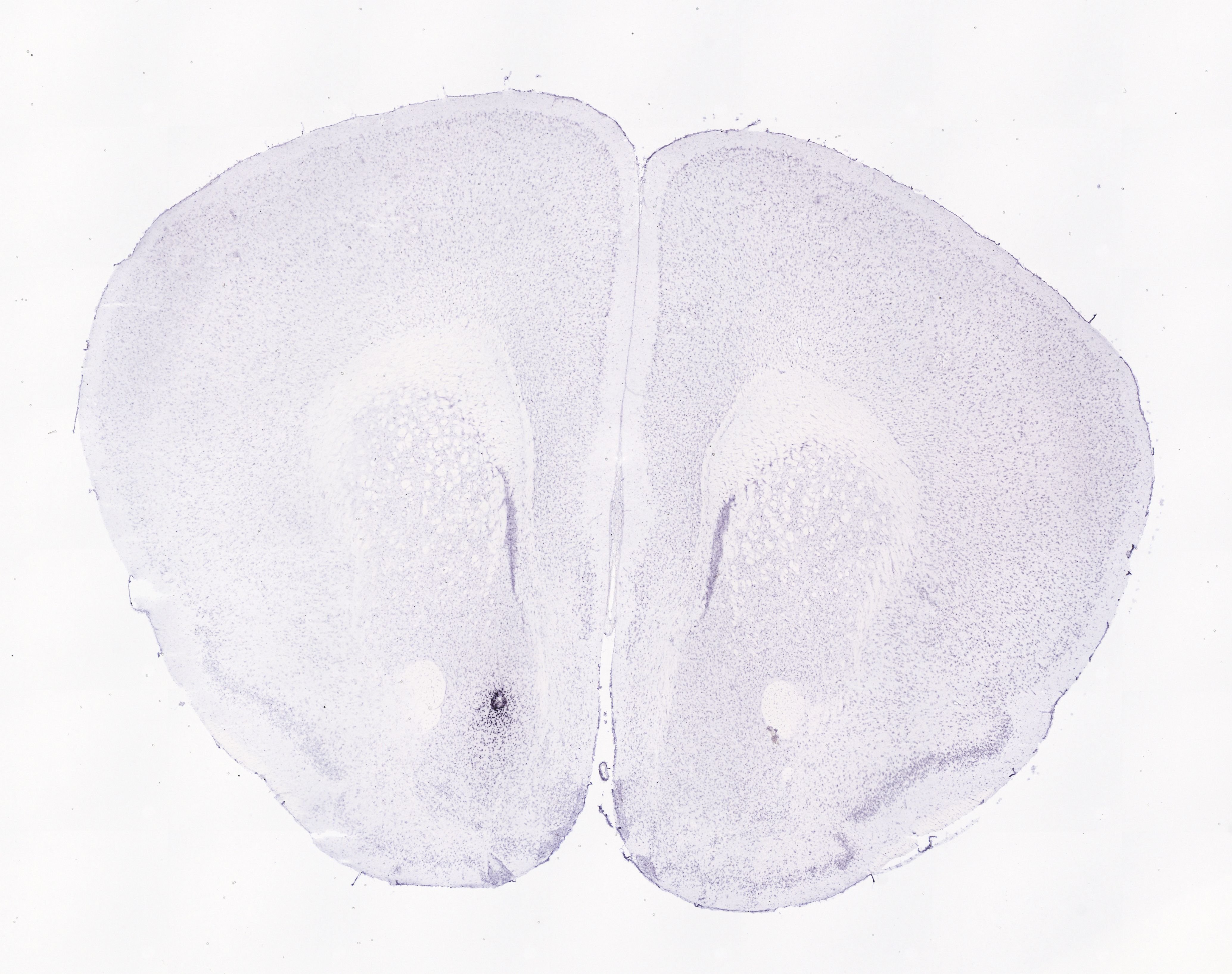 Allen ISH experiment 75651203, image 75588932 -- target region: V (Motor nucleus of trigeminal)