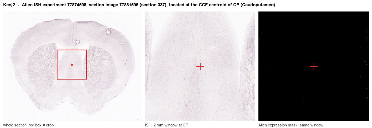 Kcnj2 Allen ISH at the CCF centroid of CP