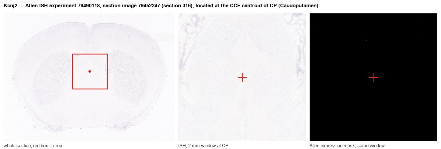 Kcnj2 Allen ISH at the CCF centroid of CP