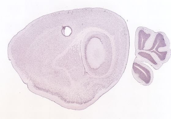Allen ISH experiment 70724864, image 70442885 -- target region: SOCl (Superior olivary complex, lateral part)