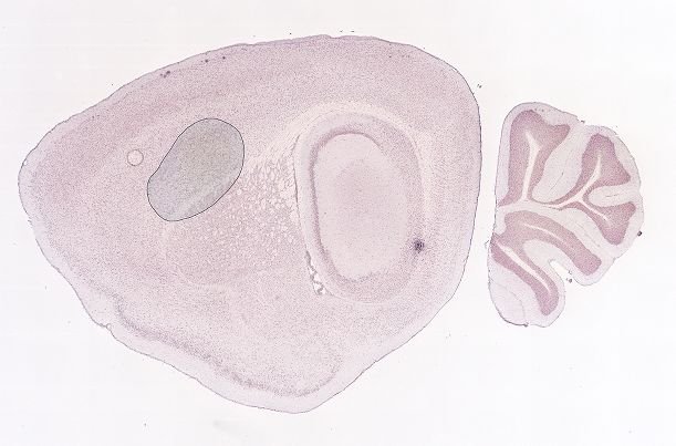 Allen ISH experiment 70724864, image 70442887 -- target region: SOCl (Superior olivary complex, lateral part)