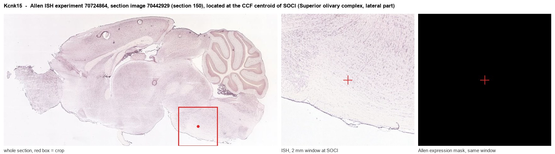 Kcnk15 Allen ISH at the CCF centroid of SOCl