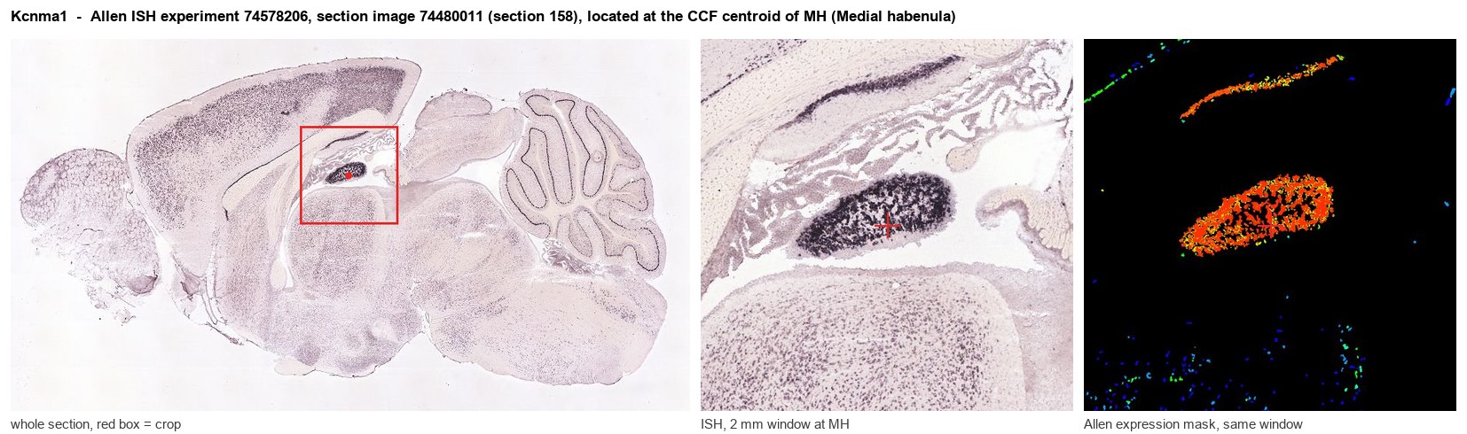 Kcnma1 Allen ISH at the CCF centroid of MH