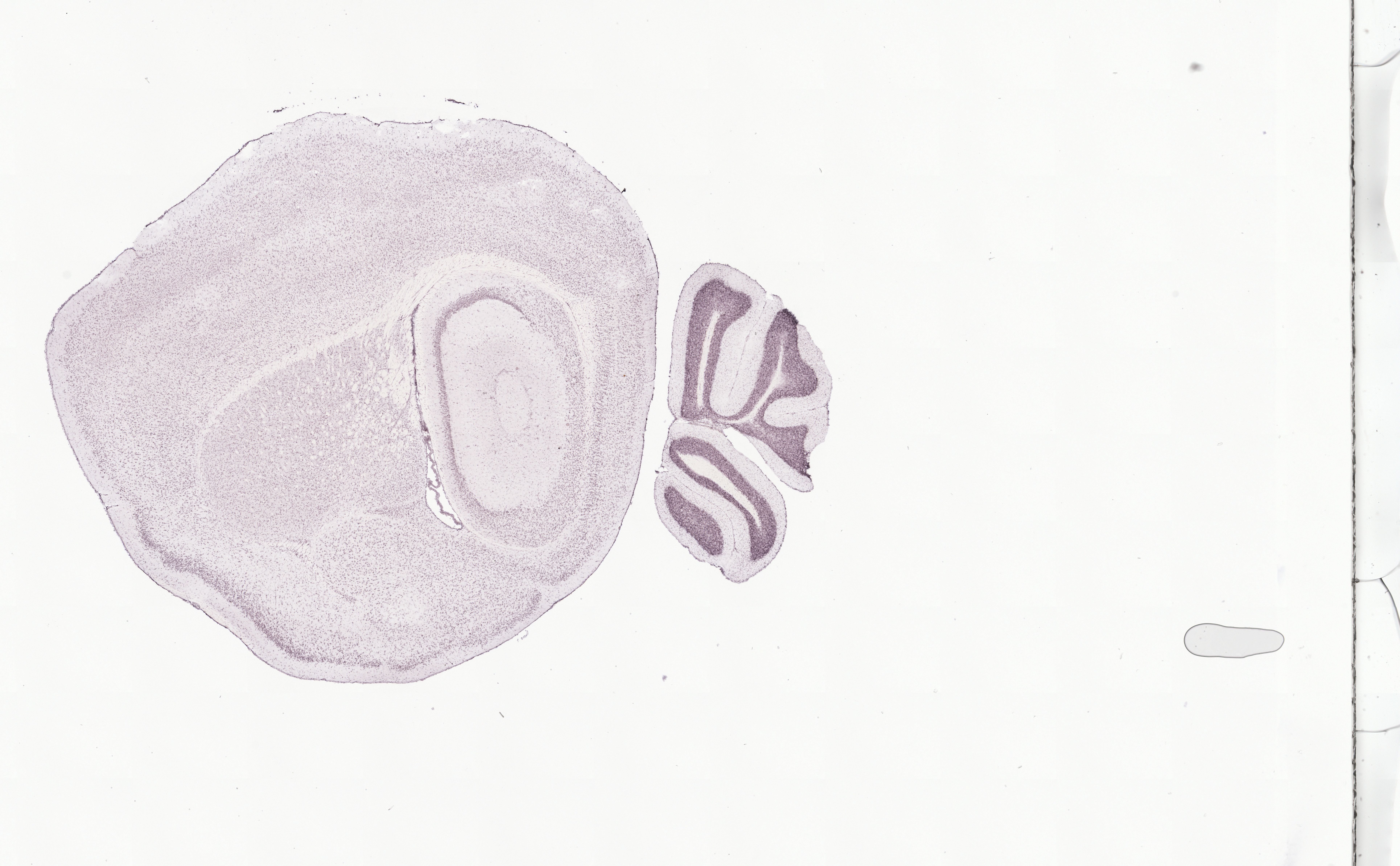 Allen ISH experiment 81599616, image 81588116 -- target region: SCO (Subcommissural organ)