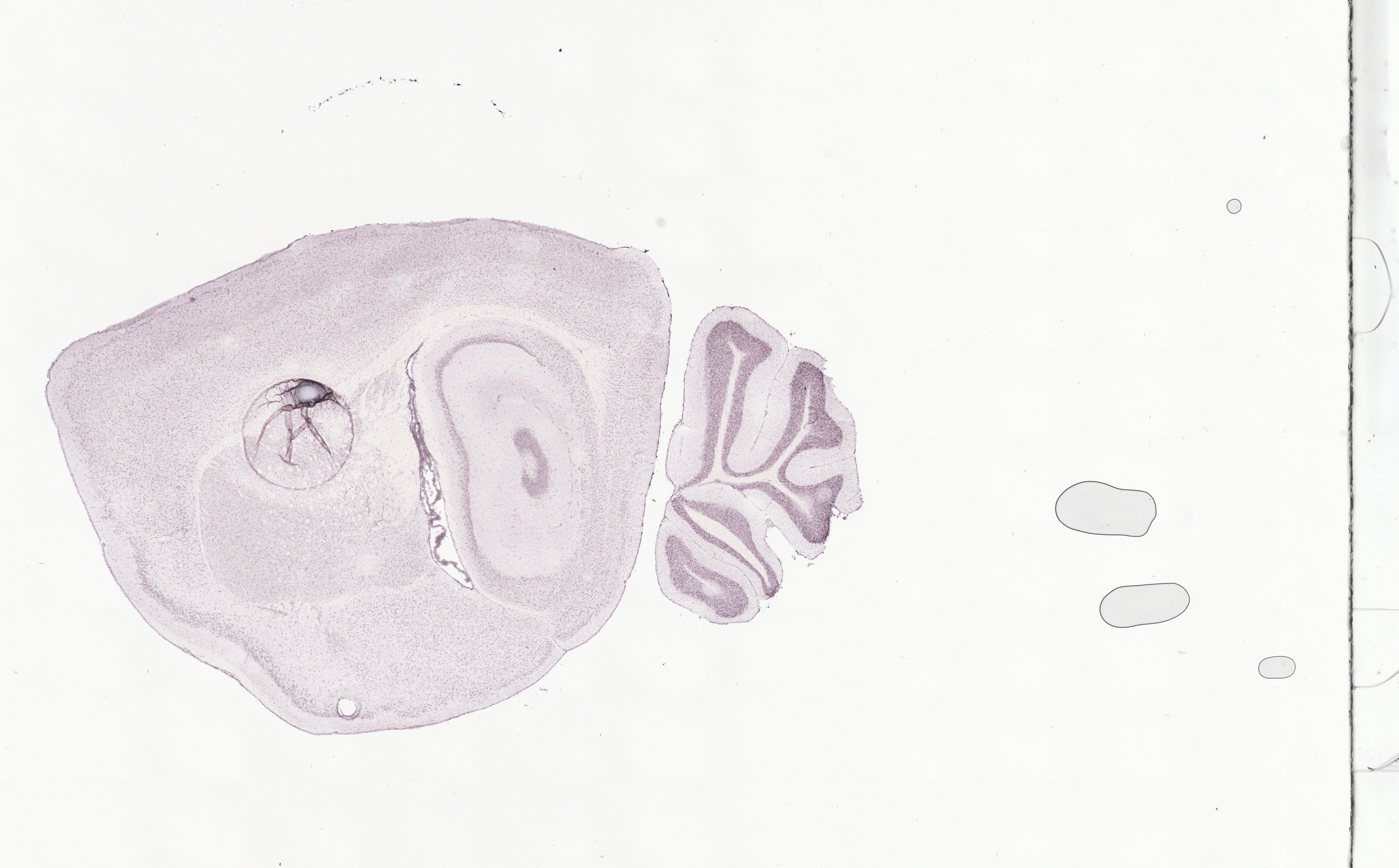 Allen ISH experiment 81599616, image 81588118 -- target region: SCO (Subcommissural organ)