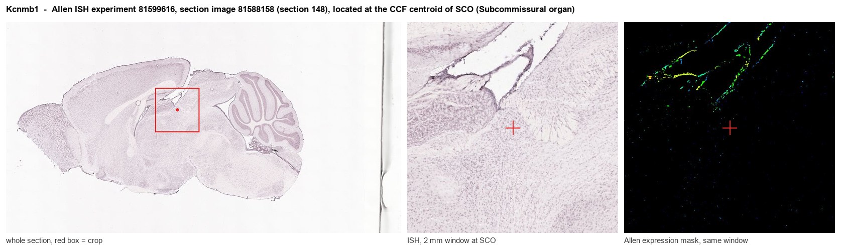 Kcnmb1 Allen ISH at the CCF centroid of SCO