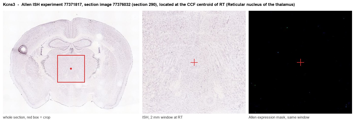 Kcns3 Allen ISH at the CCF centroid of RT