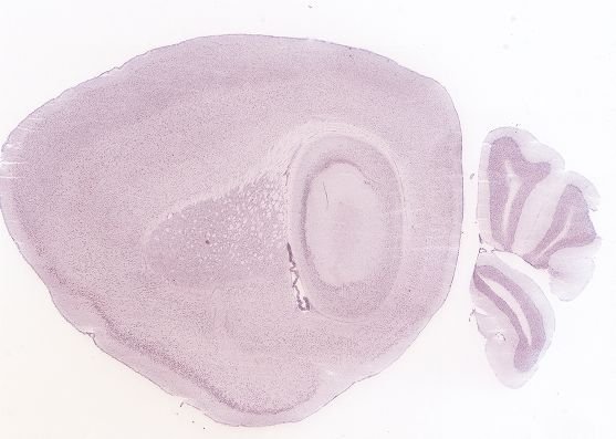 Allen ISH experiment 71529983, image 71331890 -- target region: MH (Medial habenula)