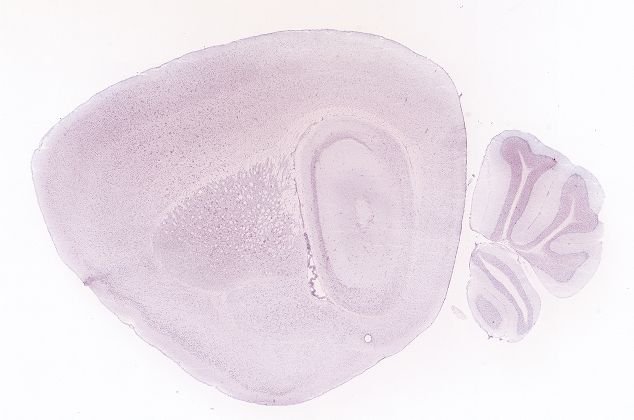 Allen ISH experiment 71529983, image 71331892 -- target region: MH (Medial habenula)