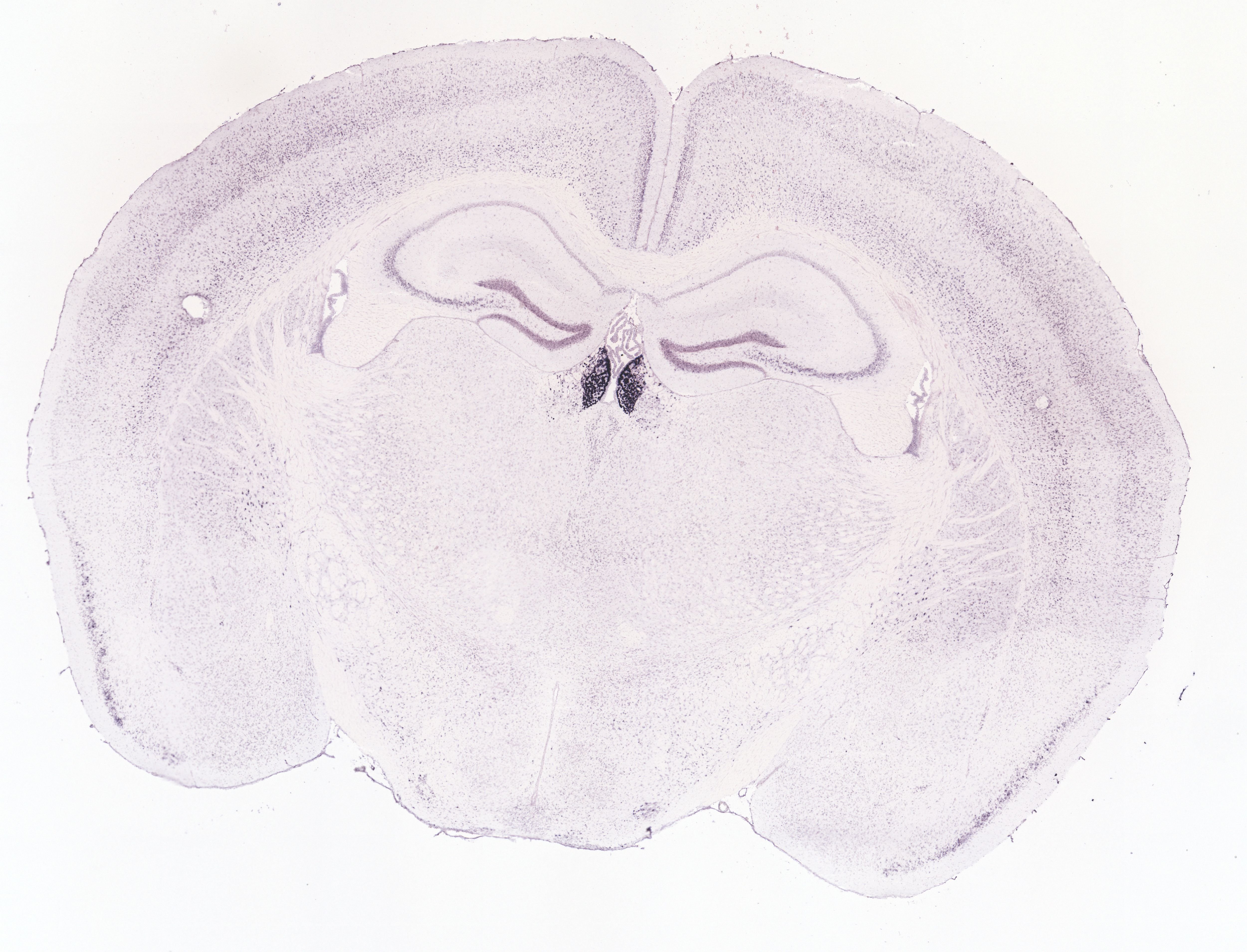 Allen ISH experiment 73931406, image 73922494 -- target region: MH (Medial habenula)