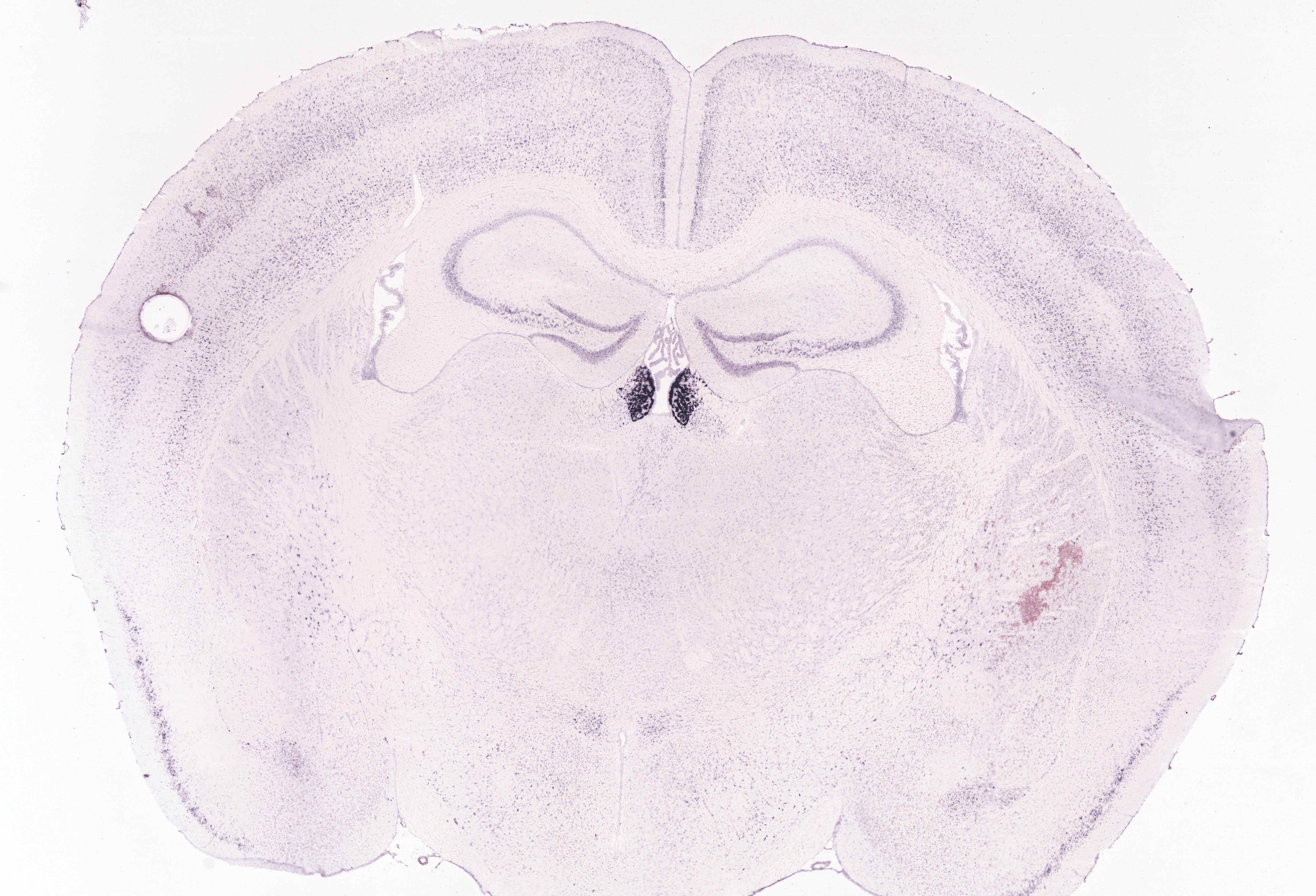 Allen ISH experiment 73931406, image 73922496 -- target region: MH (Medial habenula)