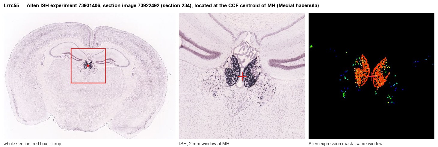 Lrrc55 Allen ISH at the CCF centroid of MH