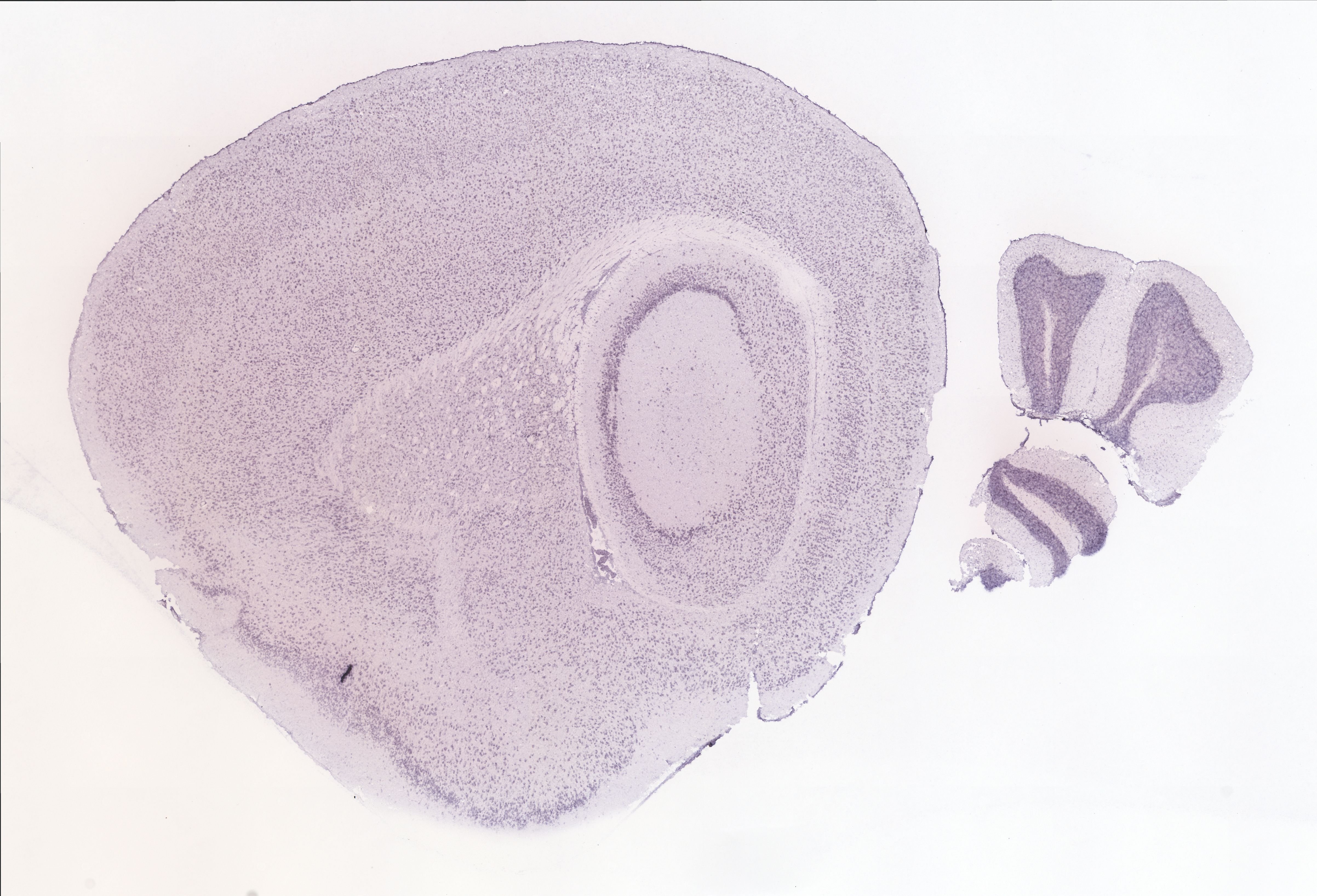 Allen ISH experiment 70201612, image 70054673 -- target region: MH (Medial habenula)