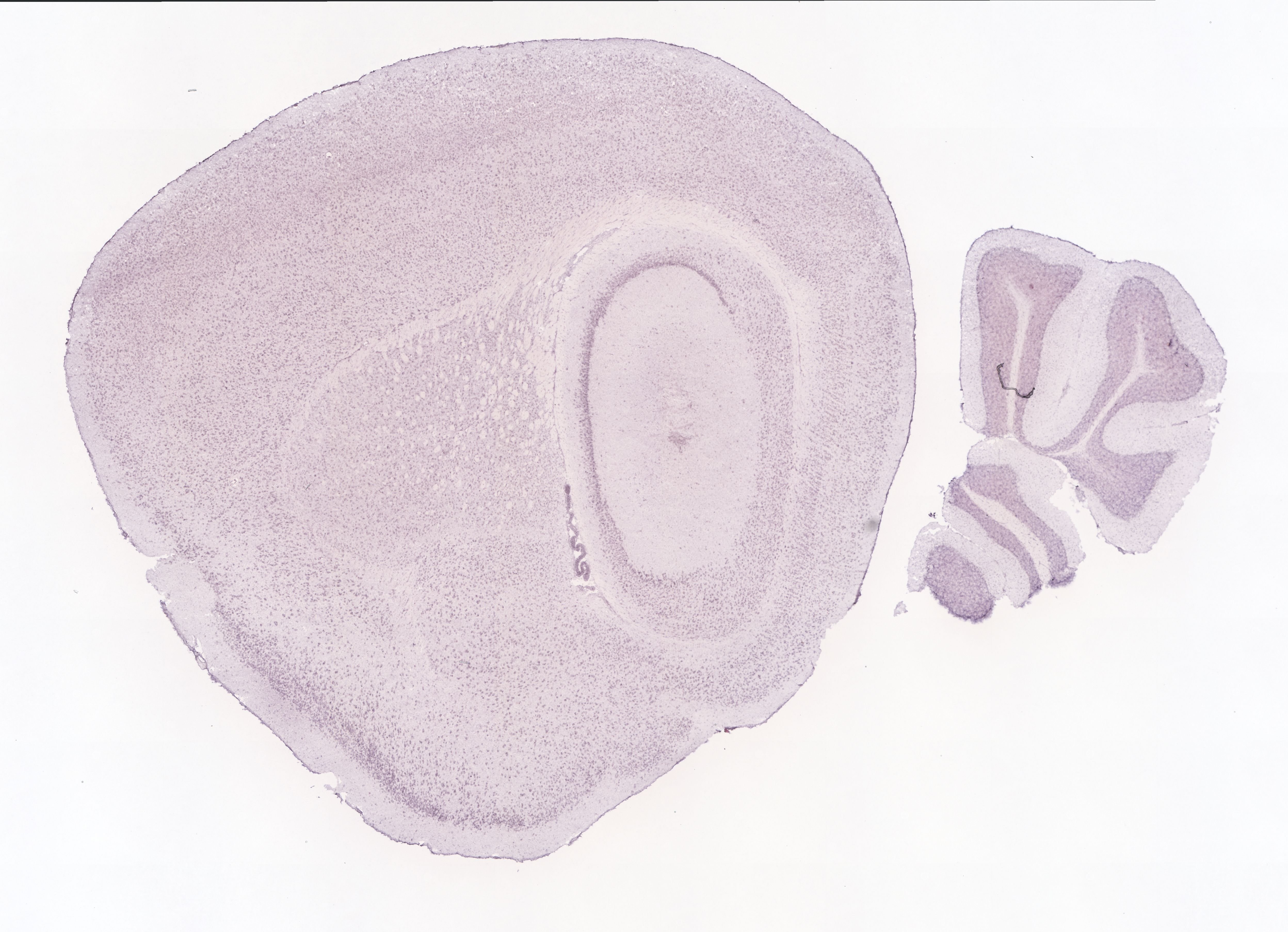 Allen ISH experiment 70201612, image 70054675 -- target region: MH (Medial habenula)