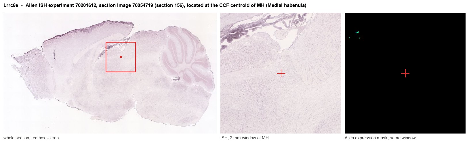 Lrrc8e Allen ISH at the CCF centroid of MH