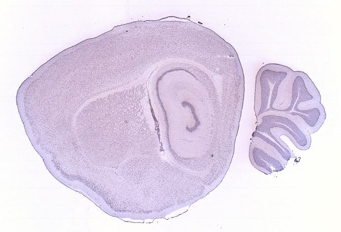 Allen ISH experiment 68744188, image 68722161 -- target region: TMd (Tuberomammillary nucleus, dorsal part)