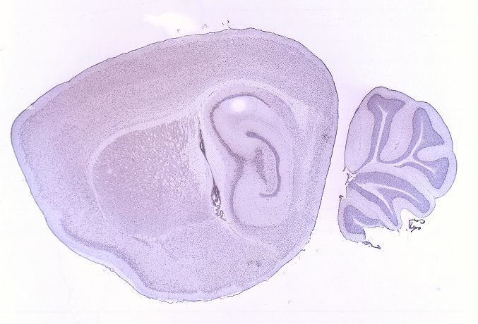 Allen ISH experiment 68744188, image 68722163 -- target region: TMd (Tuberomammillary nucleus, dorsal part)