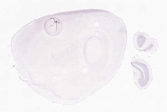 Allen ISH experiment 77800895, image 77779523 -- target region: PBG (Parabigeminal nucleus)