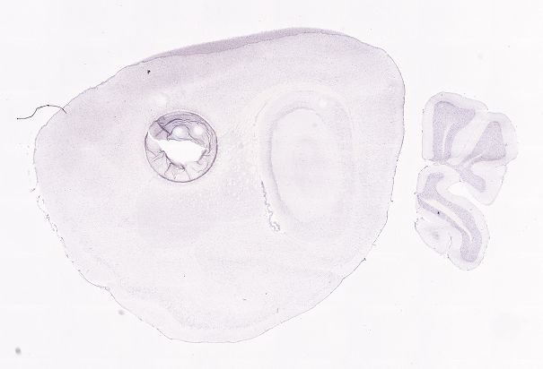 Allen ISH experiment 77800895, image 77779525 -- target region: PBG (Parabigeminal nucleus)