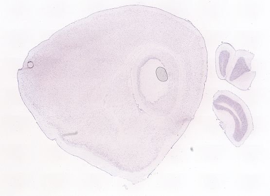 Allen ISH experiment 69258316, image 69152849 -- target region: IO (Inferior olivary complex)