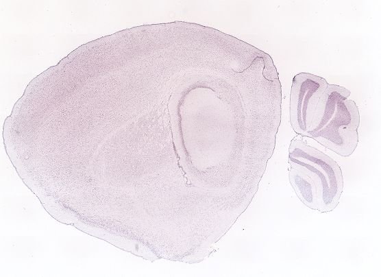 Allen ISH experiment 69258316, image 69152851 -- target region: IO (Inferior olivary complex)