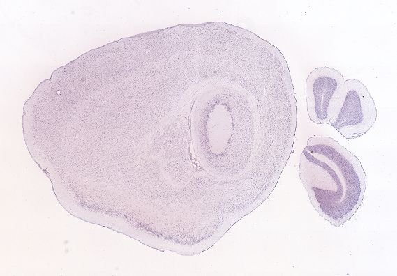 Allen ISH experiment 69258208, image 69149754 -- target region: SCH (Suprachiasmatic nucleus)