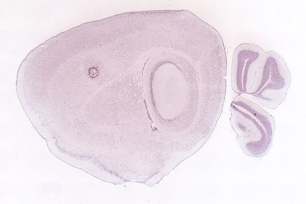 Allen ISH experiment 69258208, image 69149756 -- target region: SCH (Suprachiasmatic nucleus)
