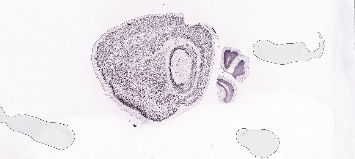 Allen ISH experiment 81655213, image 81627767 -- target region: B (Barrington's nucleus)