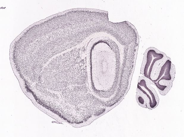 Allen ISH experiment 81655213, image 81627769 -- target region: B (Barrington's nucleus)