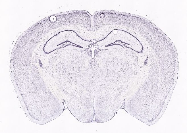 Allen ISH experiment 75773699, image 75665763 -- target region: ME (Median eminence)